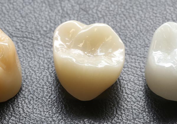 かい歯科の「高品質セラミック治療」が選ばれる理由